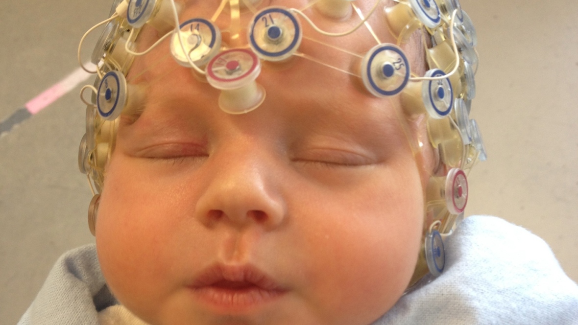 Мозг ребенка видео. Шлем для головы для развития мозга. Развиваем мозг ребенка. Бак головного мозга детям.